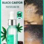 Black Castor Hair & Scalp Oil-15ml